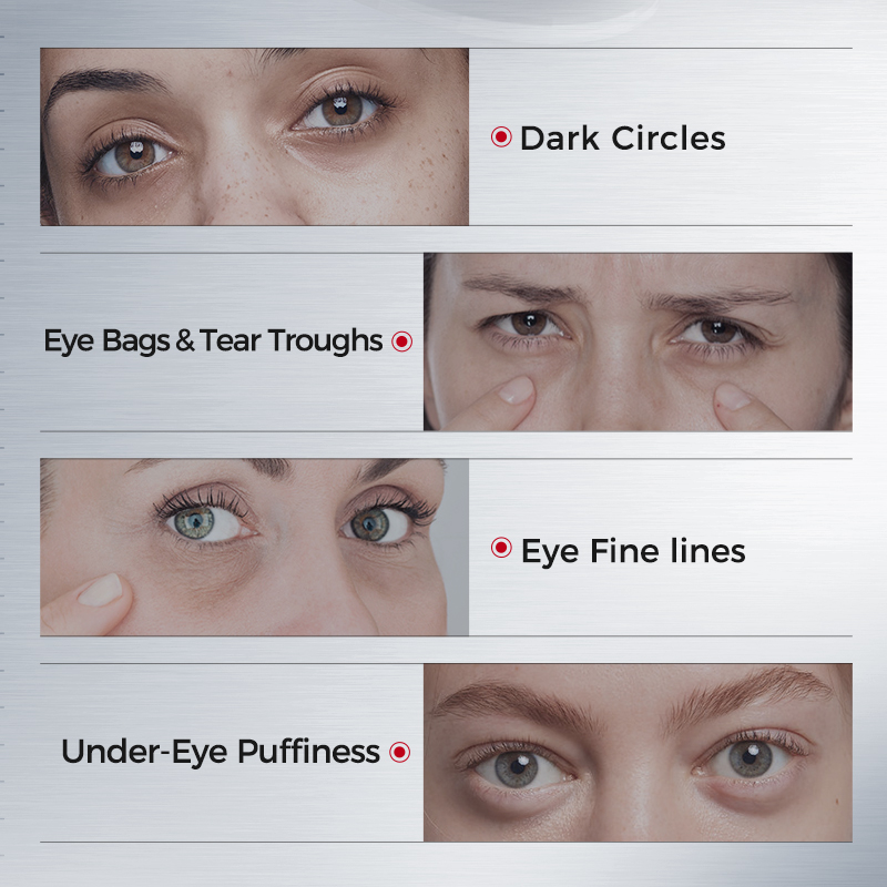 Koyu Halkalar için Göz Bantlar - Collagen Under Eye Patches incelemesi ve fiyatı
