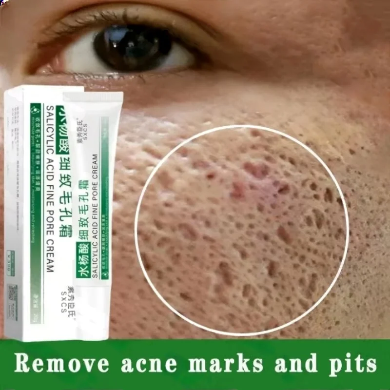 Salisilik Asit Gözenek Temizle - Salicylic Acid Blackhead Remover incelemesi ve fiyatı