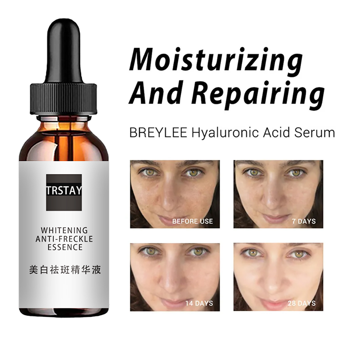 Niacinamide asit yüz özleri de - Niacinamide Pore Shrinking Essence incelemesi ve fiyatı