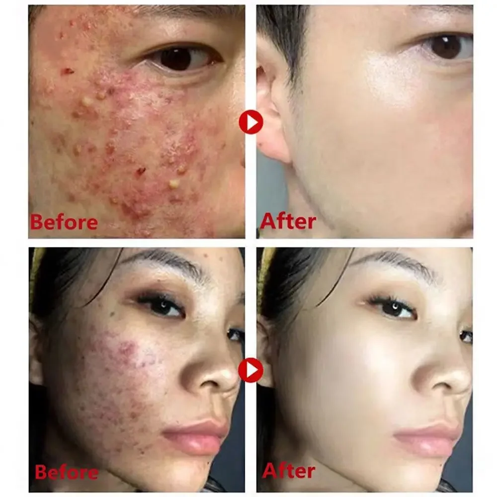 Yeşil Çay Maskesi Sopa Siyah N - Green Tea Cleansing Clay Mask incelemesi ve fiyatı